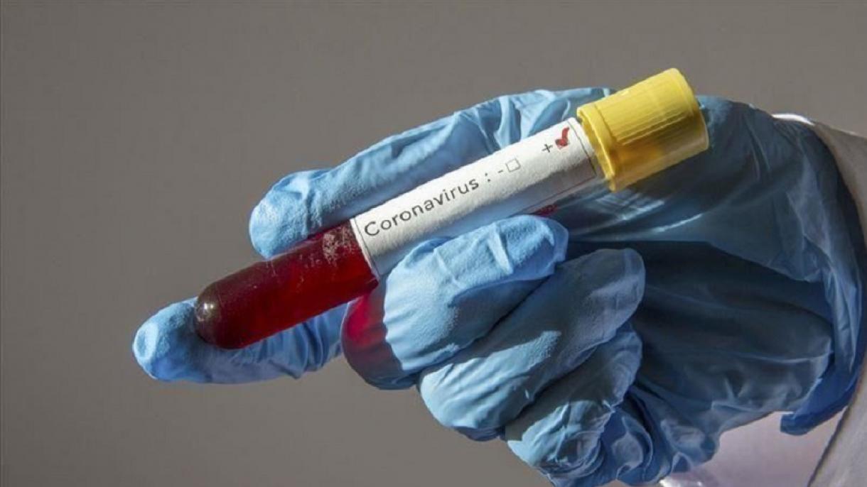 جرمنی کی کمپنی ’کیور ویک‘ کو کورونا وائرس کے خلاف ویکسین کے کلینکل ٹیسٹ کرانے کی اجازت