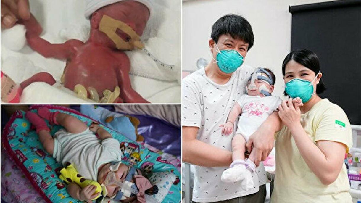 Dan de alta en al bebé más prematuro del mundo