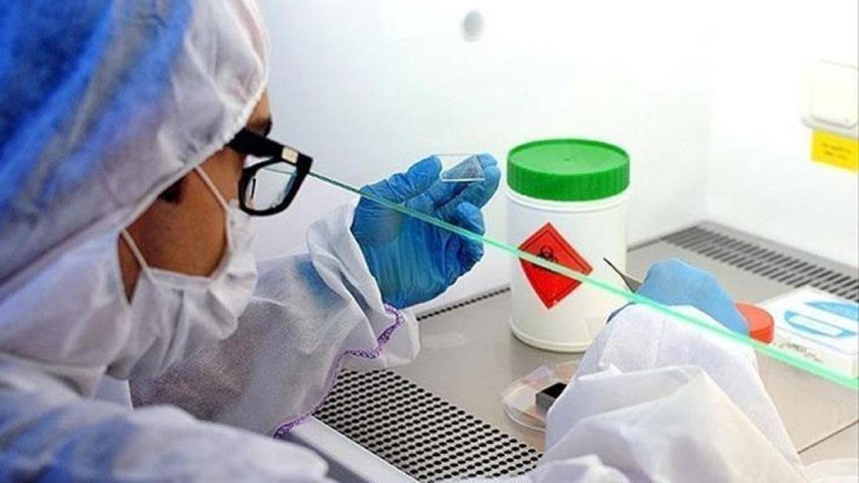 türkiyede bügün wirus sewebidin 229 kishi qaza qildi