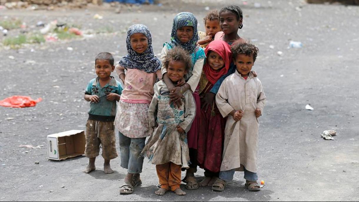 Йеменде 7 миллион бала әр күні түнді аш өткізуде.өткізуде