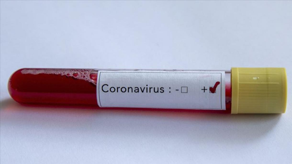Bahraynda koronavirusga chalinganlar soni 23 kishiga yetdi