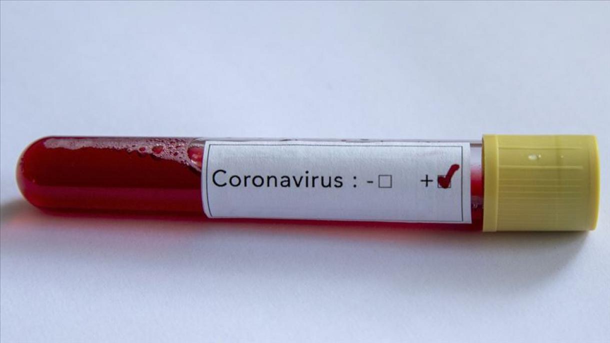 Último balance del coronavirus en Turquía