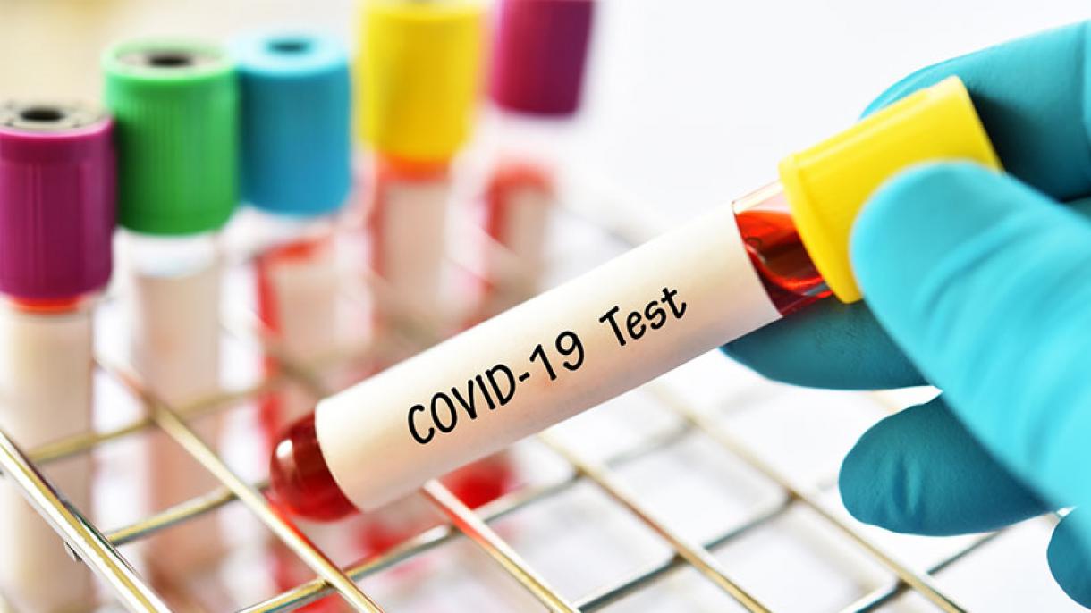 Броят на заразените с новия вид коронавирус Ковид-19 в Турция нарасна на 23 хиляди 934 души.