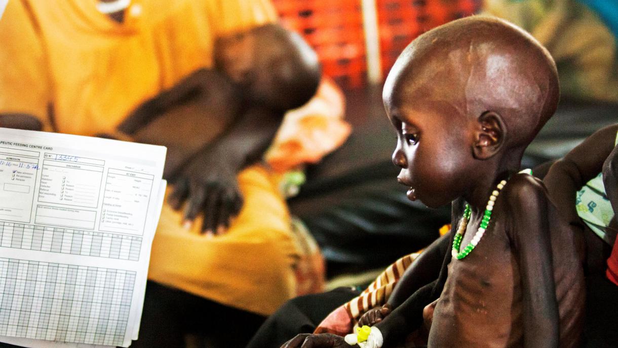 尼日利亚81名儿童死于营养不良