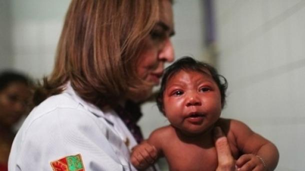 Brasil identifica 1.709 bebés con microcefalia
